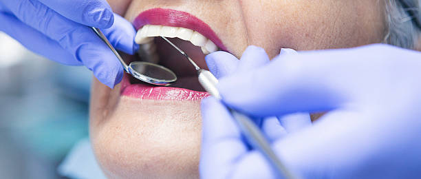 Best Emergency Wisdom Teeth Removal in Columbus, GA